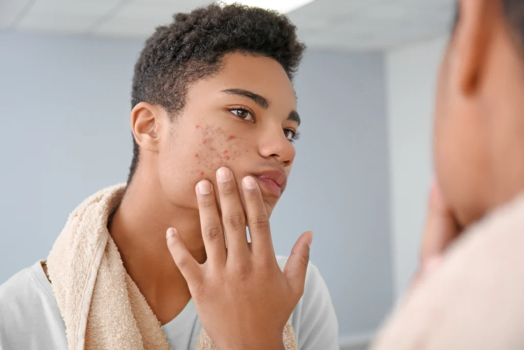 A man looking at his skin in the mirror.