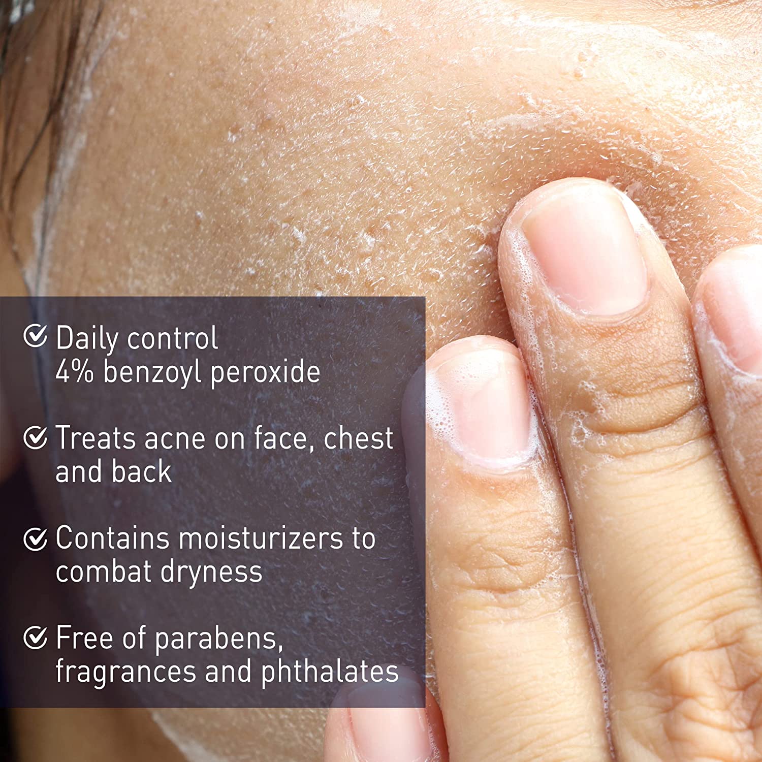 How To Remove Pimple Marks