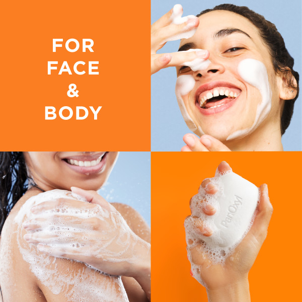 Acne Treatment Face and Body Lathering Bar
