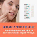Thumbnail of http://Woman%20applying%20patches.%20Clinically%20proven%20results%20-%20Visibly%20improves%20the%20look%20of%20post-acne%20marks%20in%20just%2010%20days.%20(data%20on%20file)