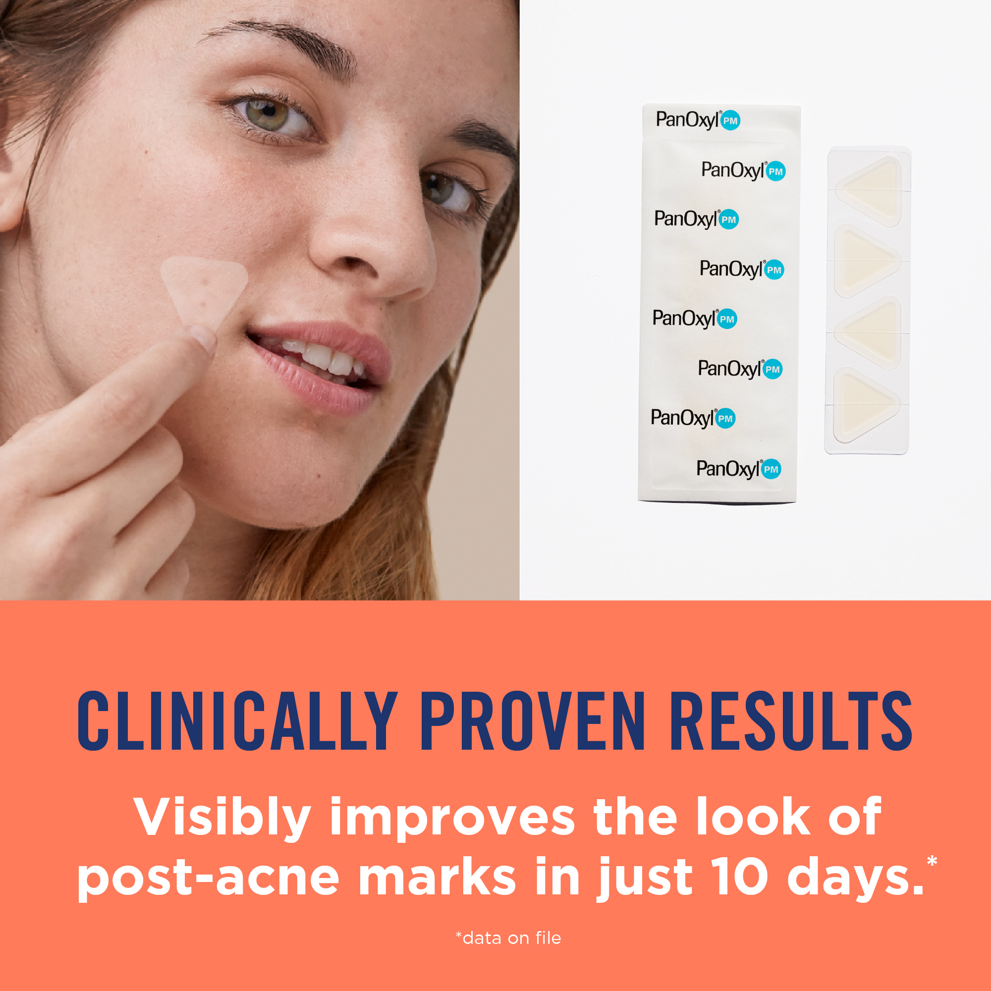 Woman applying patches. Clinically proven results - Visibly improves the look of post-acne marks in just 10 days. (data on file)