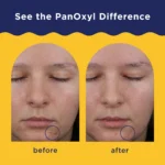 Thumbnail of 